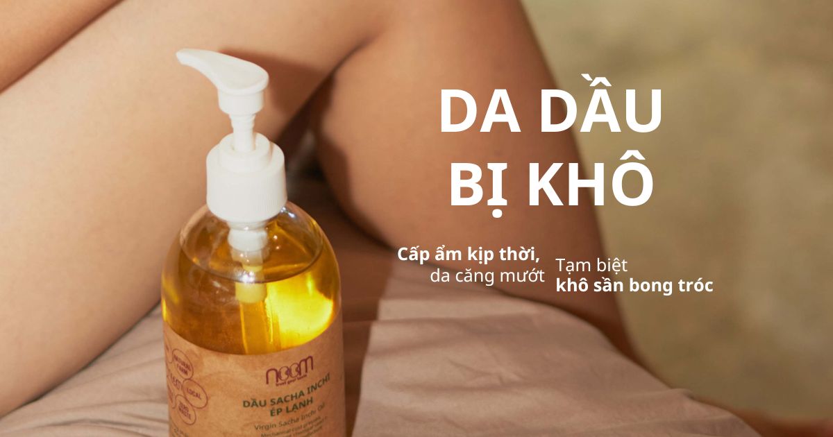 Da Dầu Bị Khô Bong Tróc