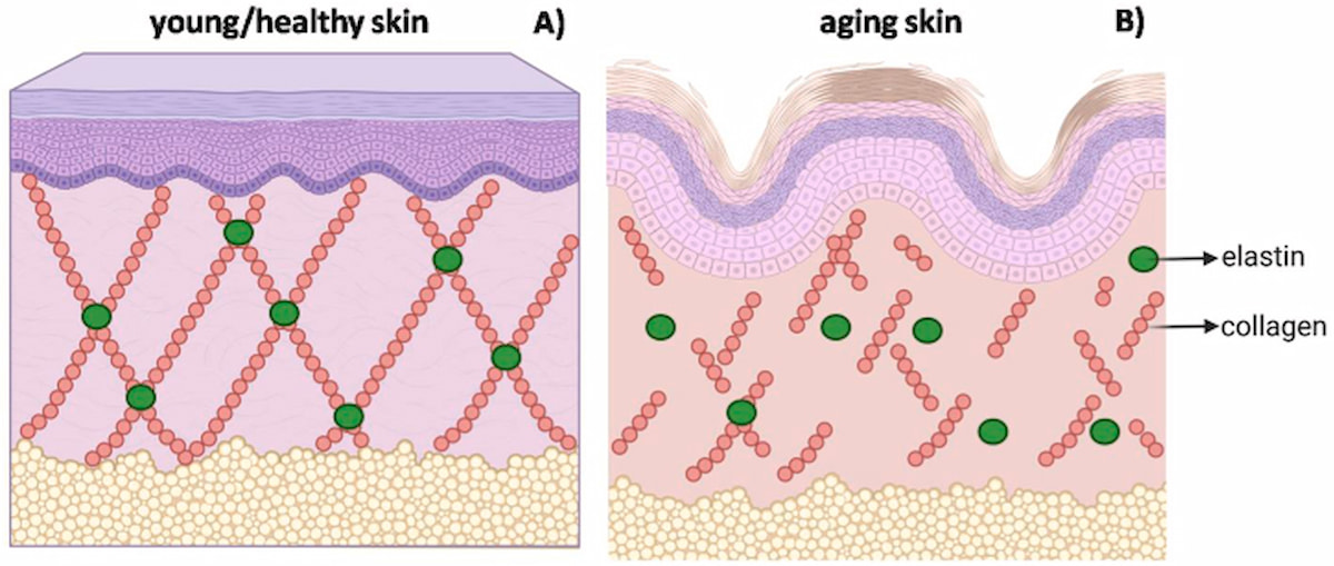 Cấu trúc của làn da trẻ khỏe (A) và làn da lão hóa (B)
