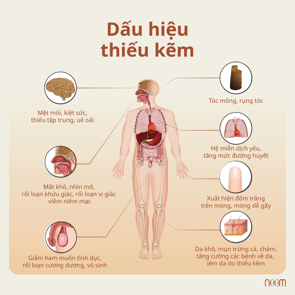 noom thuc pham giau kem 040525 3
